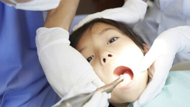 子どもの歯が黒いのは虫歯？着色？4つの原因と対策