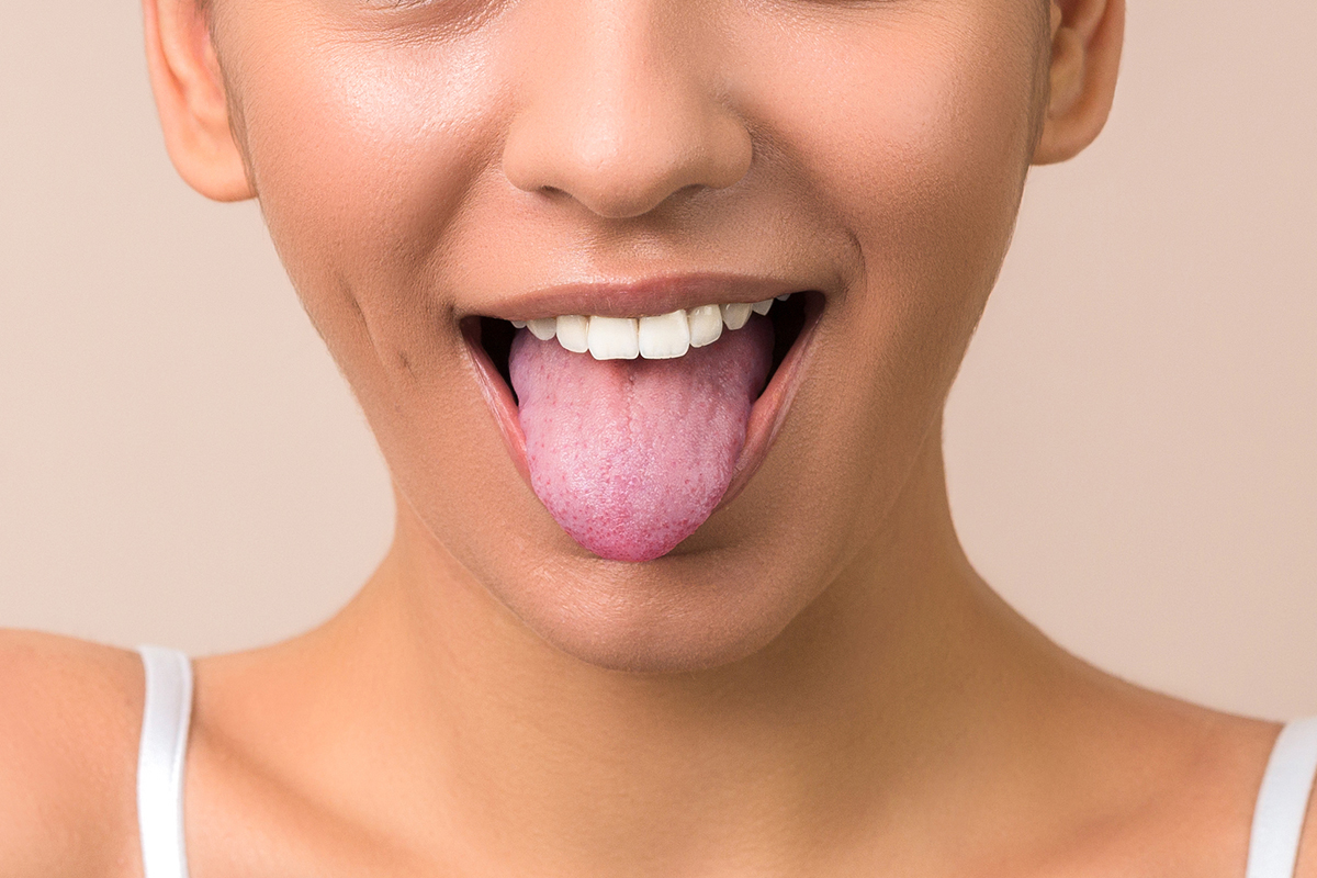 舌は健康のバロメーター