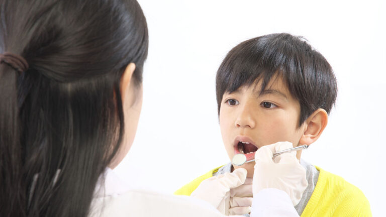 学校歯科健診と歯科医院では虫歯の判定が違う？ #歯科衛生士の教室
